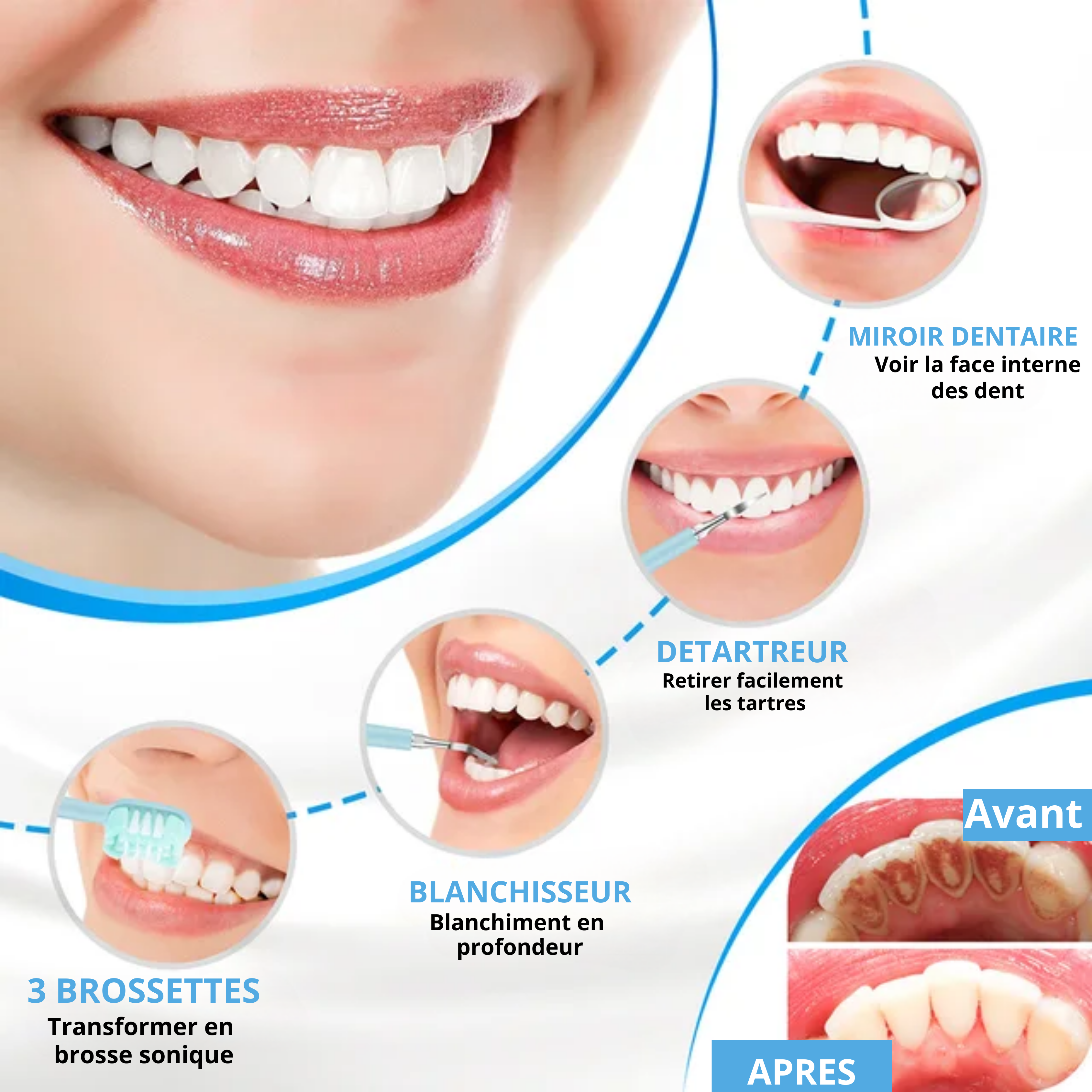 Éclat™ Kit de Blanchiment Dentaire Professionnel