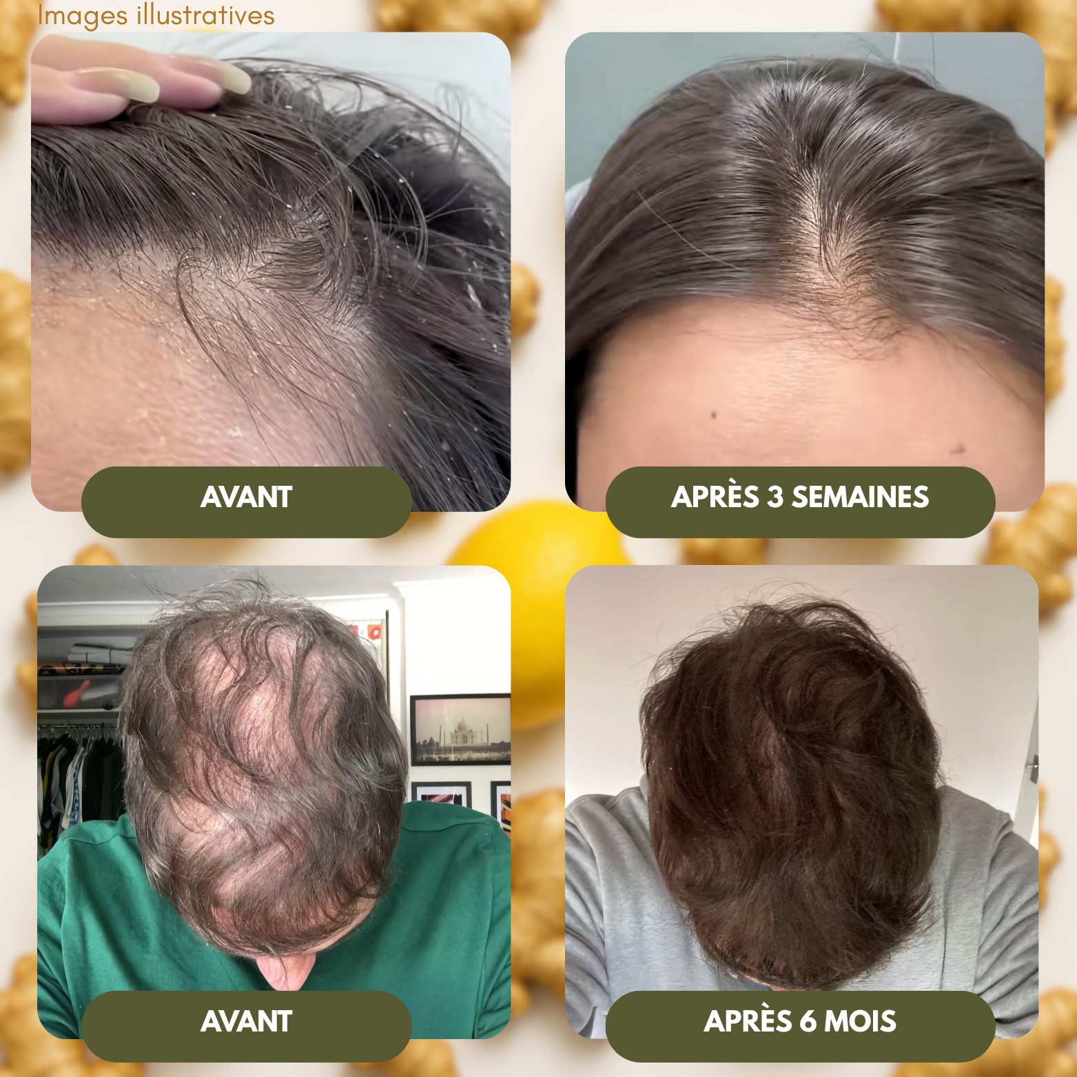 Shampoing Revitalisant au Gingembre : Dites Adieu aux Pellicules et à la Chute!